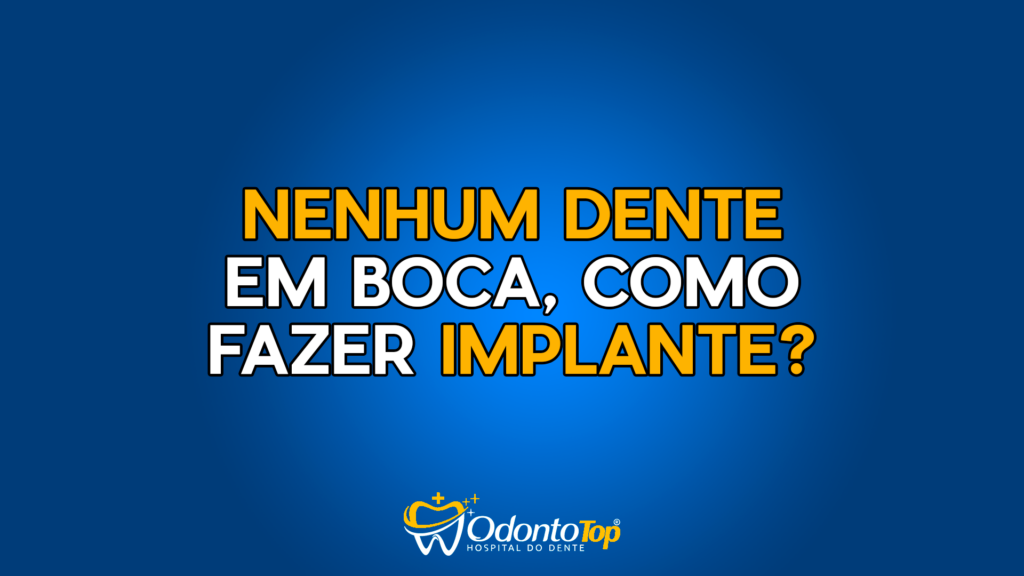 Como Fazer Implantes Quando Você Está Totalmente Sem Dentes?